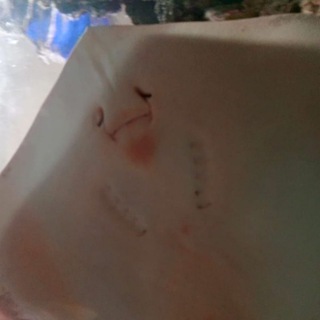 НАЧАЛОЧКА МВ