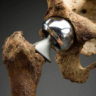 ТРАВМАТОЛОГИЯ И ОРТОПЕДИЯ