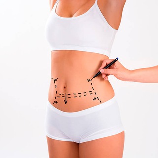 АНАТОМИЯ СИЛУЭТА® ПЛАСТИЧЕСКИЙ ХИРУРГ ОРЛОВ АНТОН, АБДОМИНОПЛАСТИКА, МАММОПЛАСТИКА, ЛИПОСАКЦИЯ, ЛИПОФИЛИНГ, БОДИЛИФТ