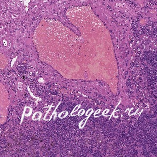 PATHOLOGEEK