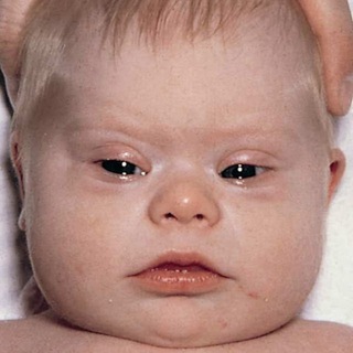 БОЛЕЗНИ | ПАТОЛОГИИ