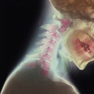 ОППАХАЙМЕР