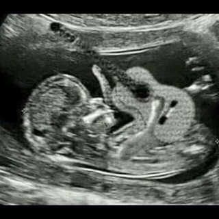 ULTRASOUND.UZ. -БИРГАЛИКДА КУРАШАМИЗ! БИРГАЛИКДА ЕНГАМИЗ!