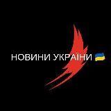 НОВИНИ УКРАЇНИ ВІЙНА