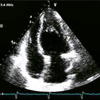 ЭХОКАРДИОГРАФИЯ/КАРДИОЛОГИЯ/ECHOCARDIOGRAPHY/CARDIOLOGY