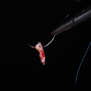 ИМПЛАНТАЦИЯ КАК ИСКУССТВО