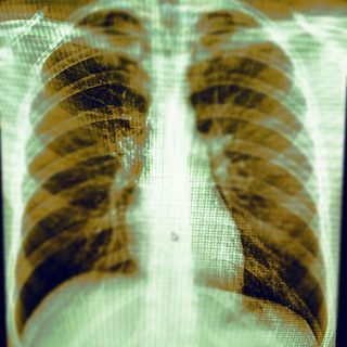 RADIOLOGY/РЕНТГЕНОЛОГИЯ ЧАТ