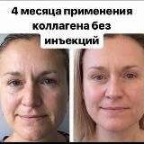  ОТЗЫВЫ20 / КОЛЛАГЕН/ COLLAGEN NL ФОТО/ ОТЗЫВЫ 