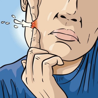 АКНЕФОБИЯ | ПРЫЩИ