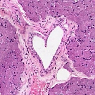 ГИСТА КИНДЕРОВ