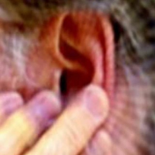 ACÚFENOS Y TINNITUS