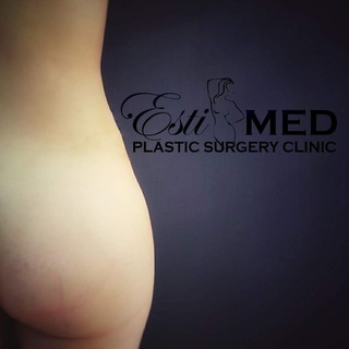 ПРОСТО О ПЛАСТИКЕ (ПОП)